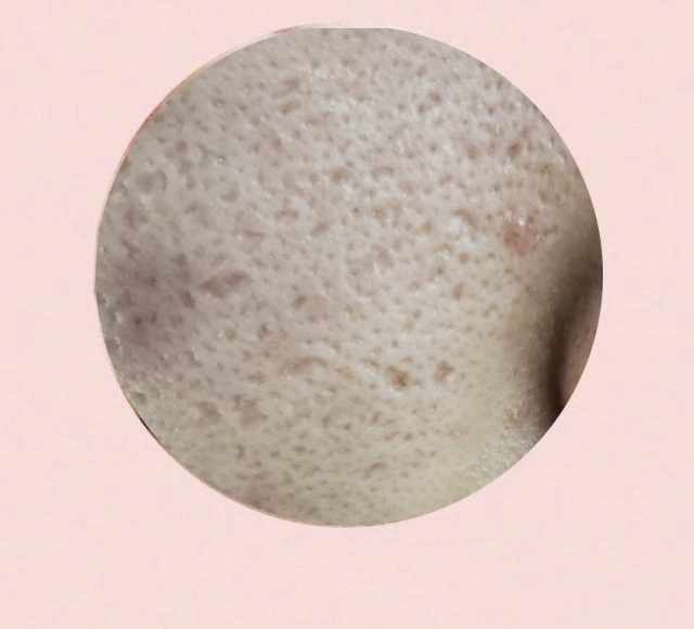 油皮毛孔粗大洗面奶,油皮毛孔粗大怎么补水