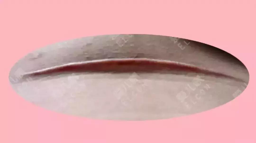 产后侧切刀口痒是怎么回事,产后刀口痒怎么回事