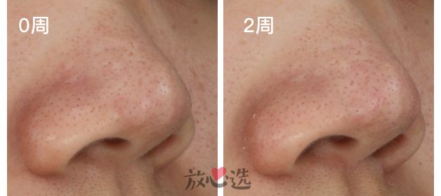 好用的毛孔收敛产品,收敛水收缩毛孔推荐真实