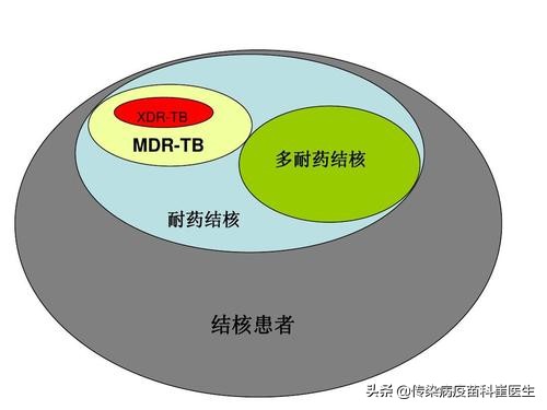得了结核病一般需要治疗多长时间,结核病需要治疗多长时间能好