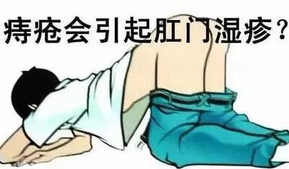 湿疹问题在哪里,湿疹症状健康科普