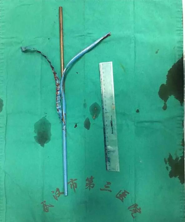 小区装24个摄像头被曝光,这个小区装了24个高清摄像头