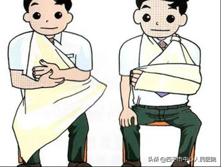 肋骨骨折恢复期一般多久,13根肋骨骨折