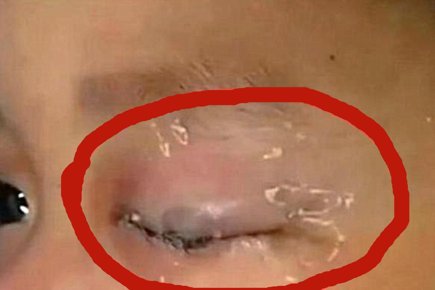 一岁半宝宝误食502胶,好在妈妈淡定处理,医生:妈妈机智