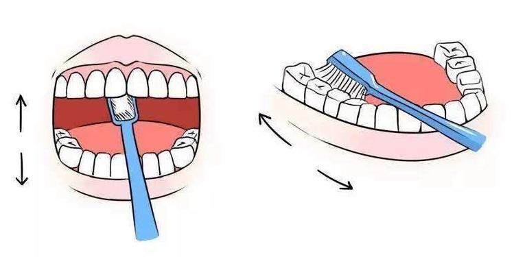 牙结石如何彻底清理干净,自己如何有效的清除牙结石