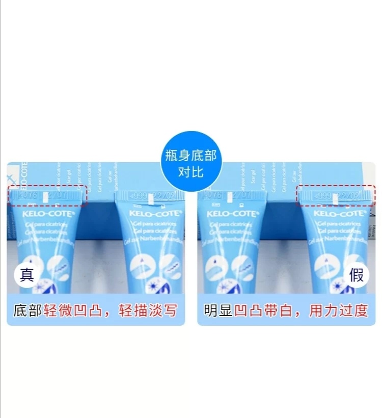 你用过最好的祛疤方法,小红书推荐祛疤真的有效吗