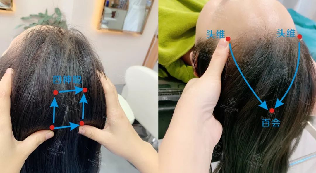 专家推荐治疗脱发白发食疗药酒,中医调理白发脱发养发