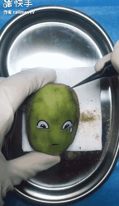 我在快手上看人切洋葱，竟然弄懂了剖腹产？