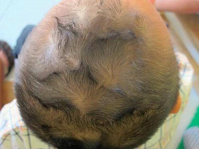 宝宝头旋不同数量和位置，暗示不同人生，很多人想错了