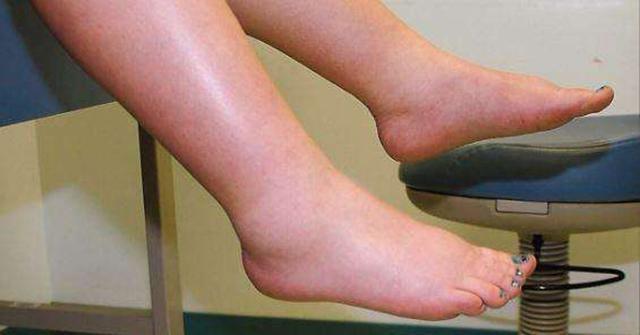 怀孕6个月胎盘低出血注意些什么,5到6周孕妇的注意事项