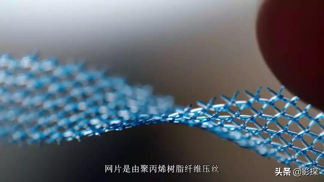 网飞利润,网飞靠什么盈利