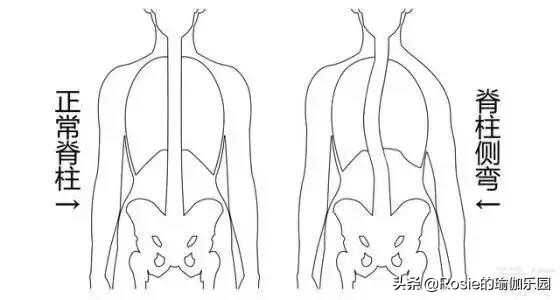 方领衣服肩带老是往下掉怎么办,穿衣服领口老是往下掉