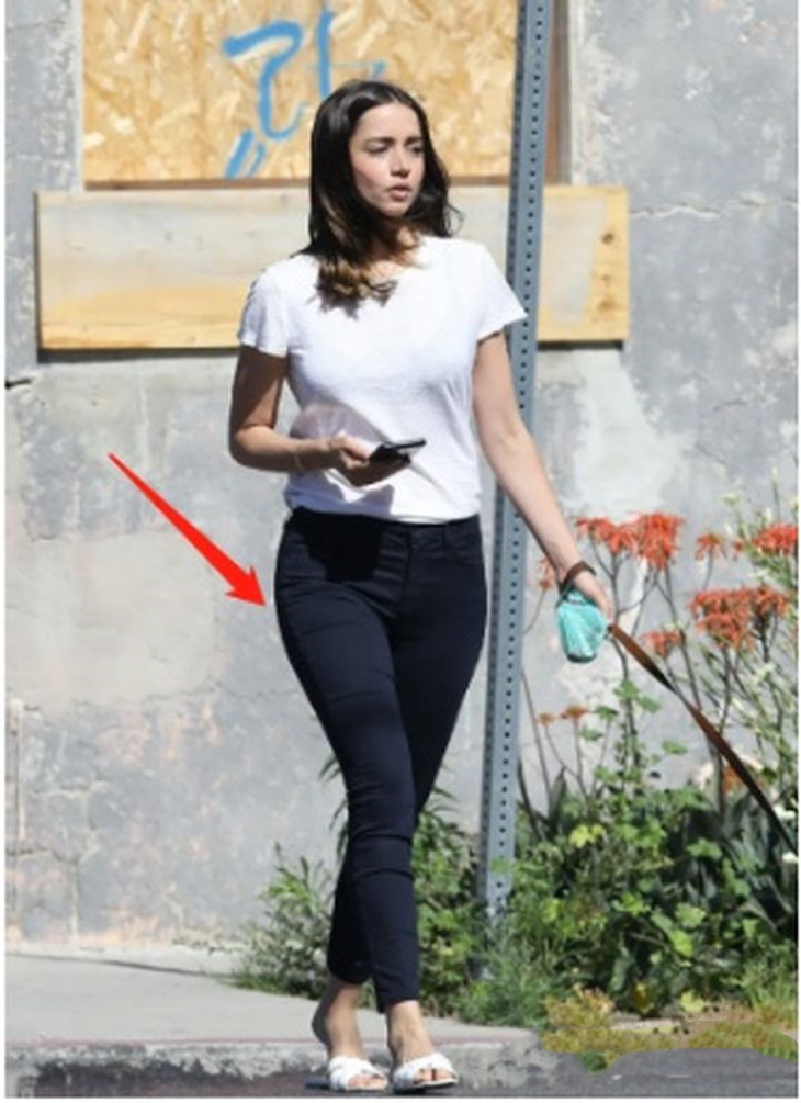 女性腰腹吸脂手术全过程,肥胖的人可以吸脂减肥吗