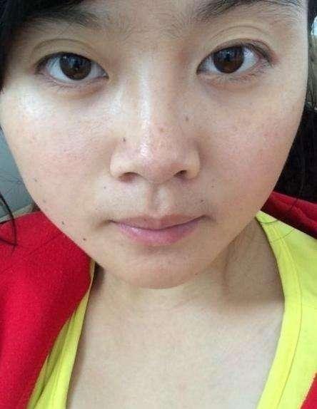 维e乳膏的其他妙用,维e可以和其他药膏一起用吗