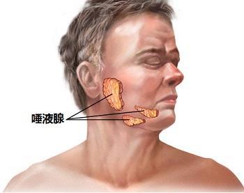 36岁女子一吃饭下巴就痛,这是什么怪病?医生:嘴巴里有个石头