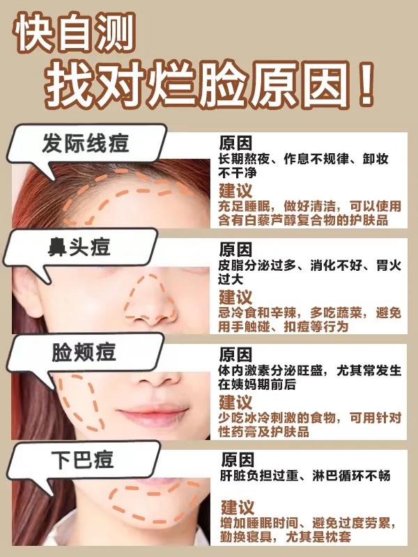 战痘第一步先要认清痘痘类型,科普长痘原因和建议