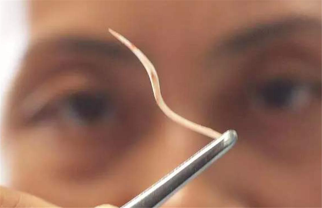 小孩异物卡喉急救方法,孩子异物卡喉急救后未排出没事吗