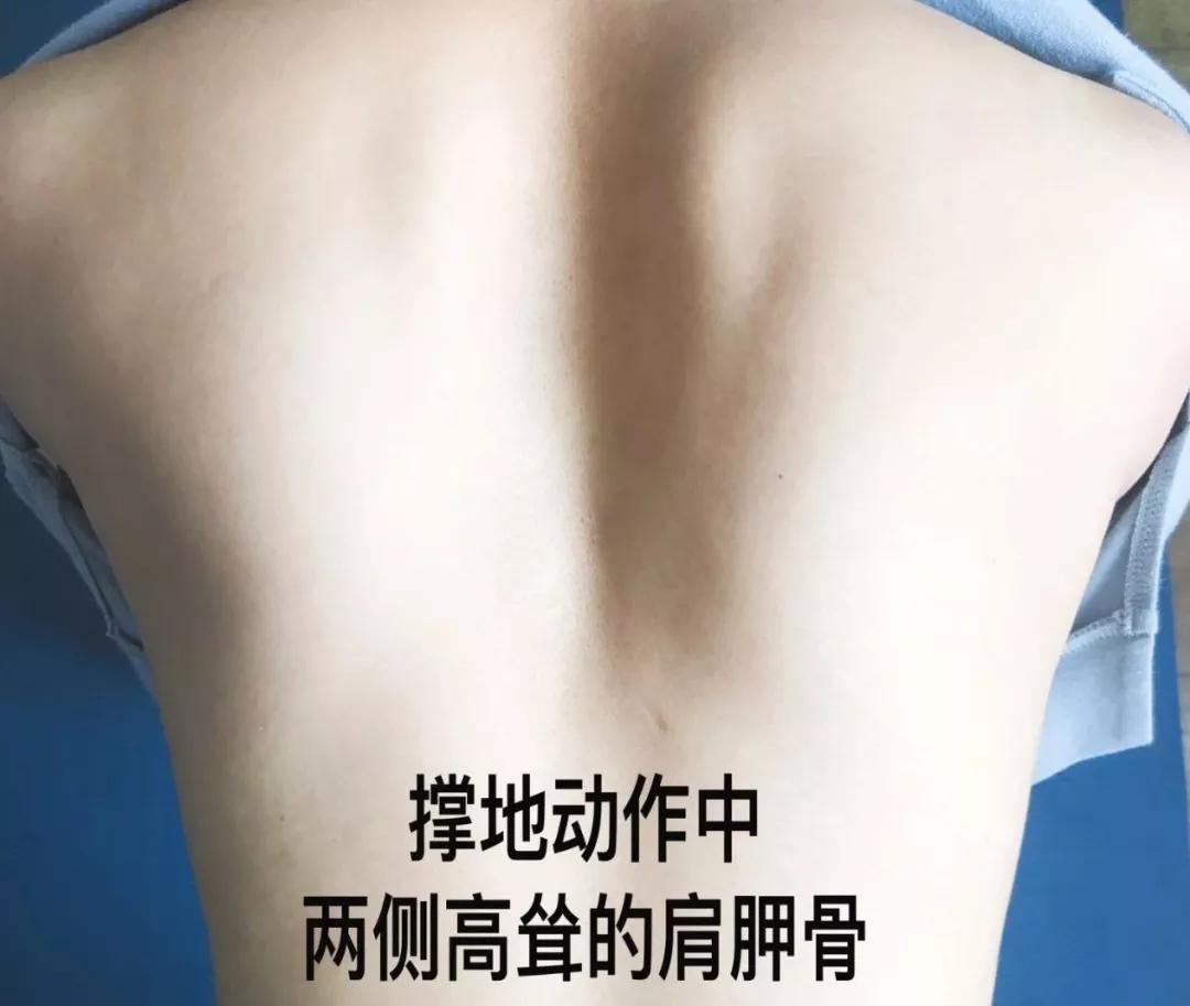 肩膀嘎吱嘎吱响,是何原因?如何解决?