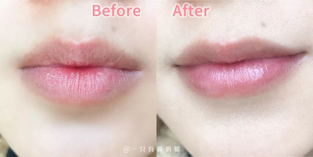 空管润唇膏,润唇膏空管