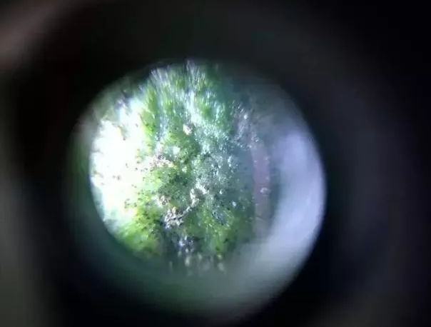 柑橘表皮有疙瘩怎么治疗,柑橘沙皮病危害