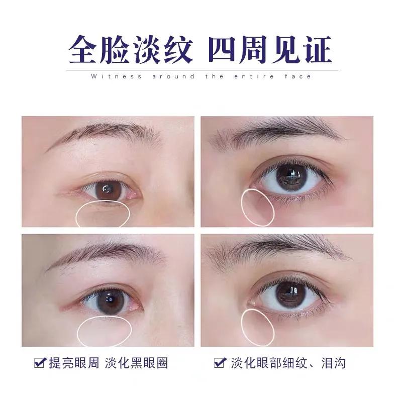 欧莱雅眼霜紫熨斗自带按摩头,欧莱雅复颜抗皱眼霜和紫熨斗