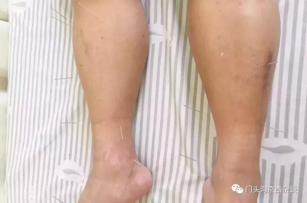 北京门头沟摩托车俱乐部,门头沟地中海俱乐部