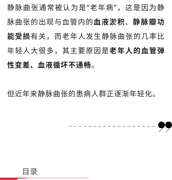 预防静脉曲张的关键就是了解病因,精索静脉曲张的原因