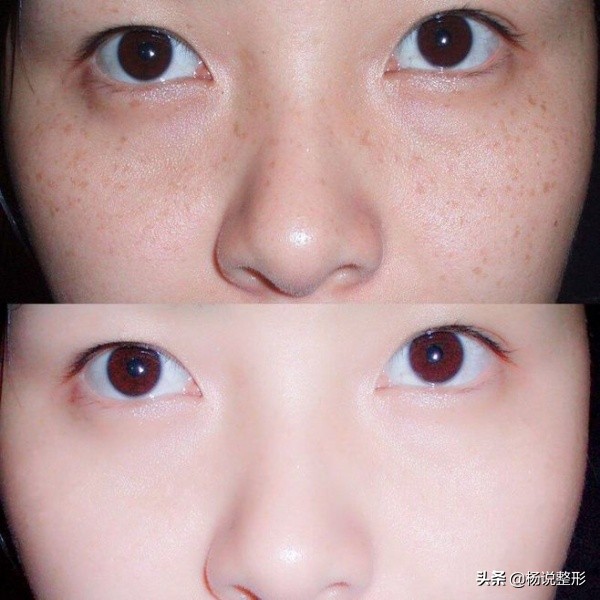 祛斑干货！内服、外调*管双**齐下，具体怎么做？