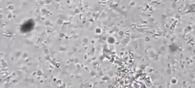 肚脐眼用显微镜放大1000倍,抠肚脐眼里的泥全过程