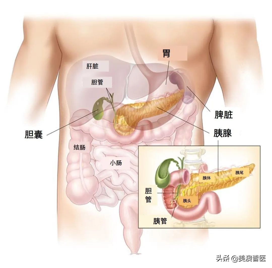 吃海鲜容易得胰腺炎,胰腺炎是胡吃海喝造成的吗