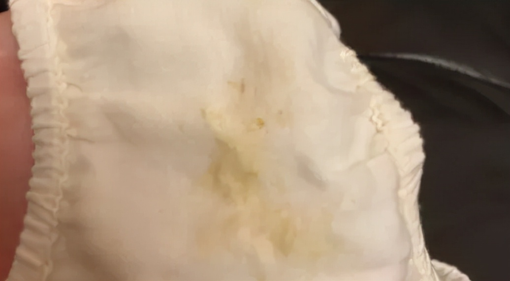 女宝裤头有黄色正常吗,女童裤上有绿渍正常吗