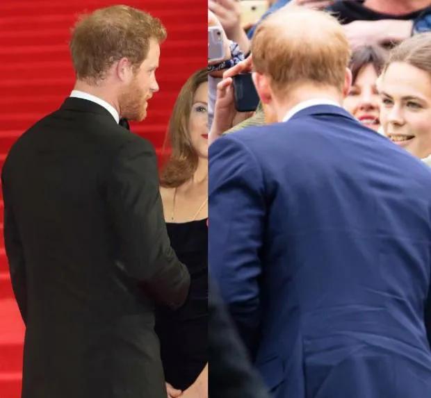 小贝为何剃光头,贝克汉姆的头秃