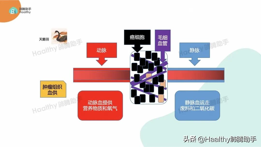 肺癌伴有骨转移最好的治疗办法,肺癌靶向治疗后骨转移怎么办