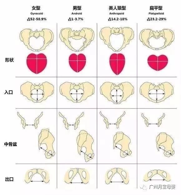 屁股大的女人生育好吗,屁股大的女生好生养