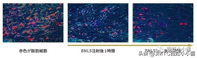 日本小姐姐针灸瘦脸视频,小姐姐打瘦脸针视频