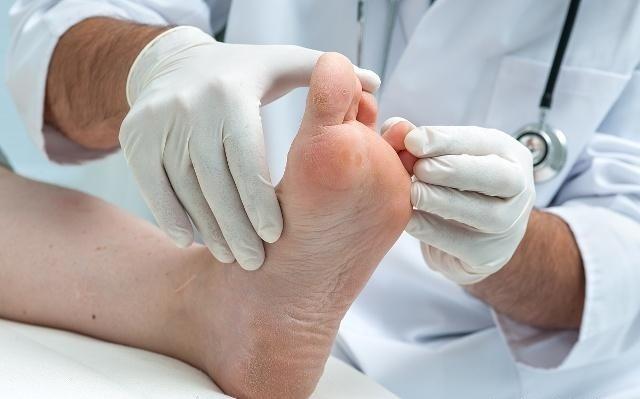 怎样才能简单让臭脚去臭,现在治脚臭的办法