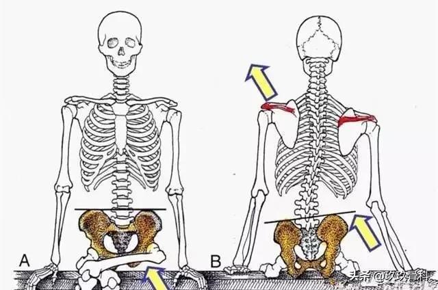 沉迷翘二郎腿的你，骨盆还好吗？