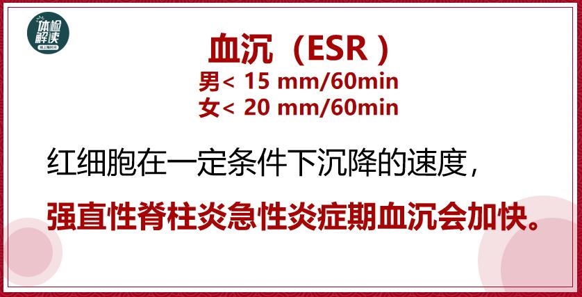 张嘉译得了强直性脊柱炎多少年了,张嘉译强直性脊柱炎的现状视频