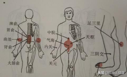 月经不调，你还在吃药吗？拔罐疗法也是很好的选择