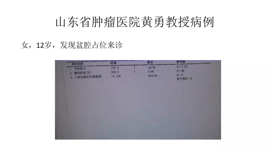 卵巢原发肿瘤的分析思路