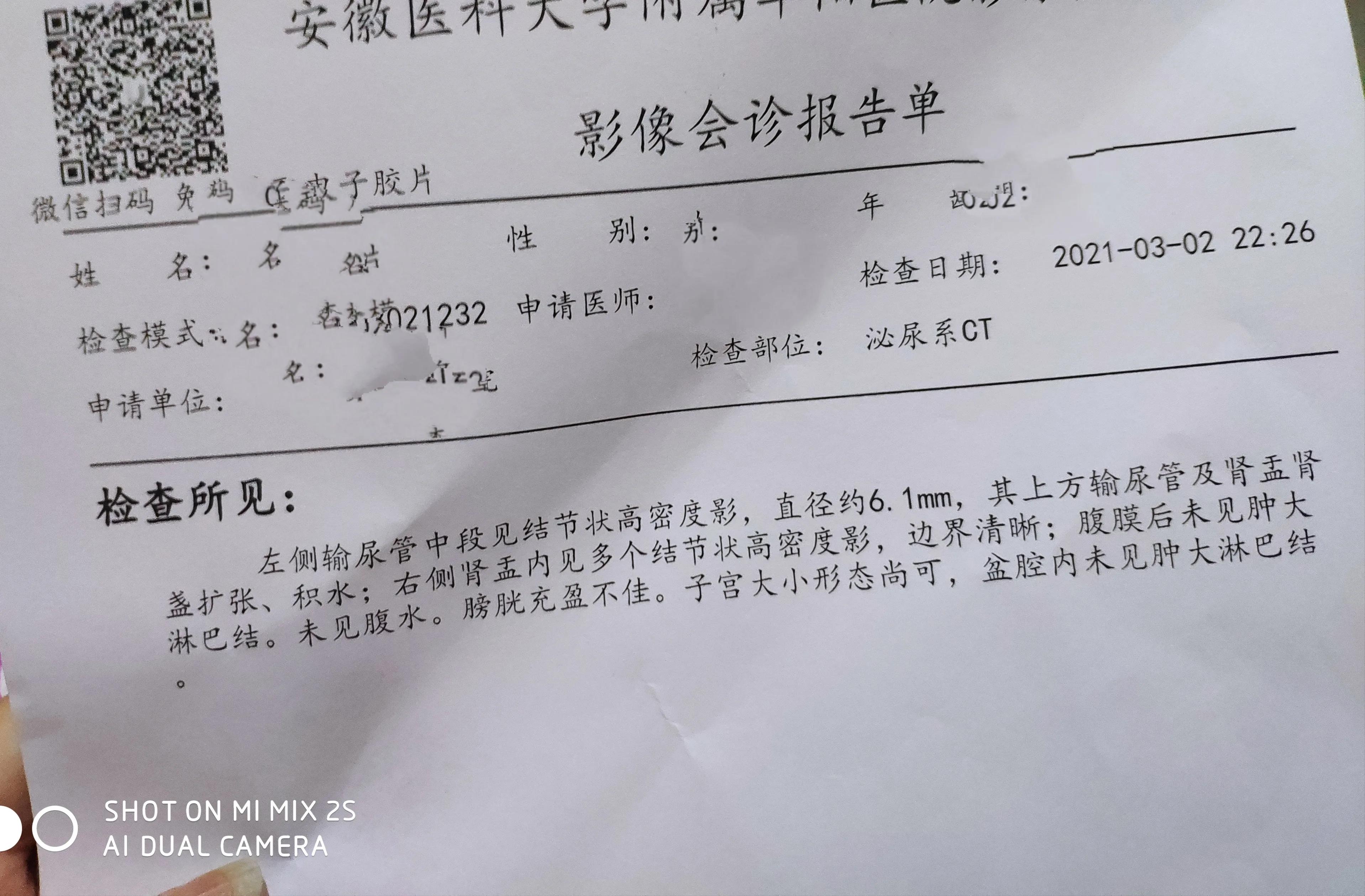 上班途中结石突然疼痛,左腹痛恶心呕吐一定是结石吗