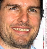 正畸医生如何指定方案的,正畸医生怎么说