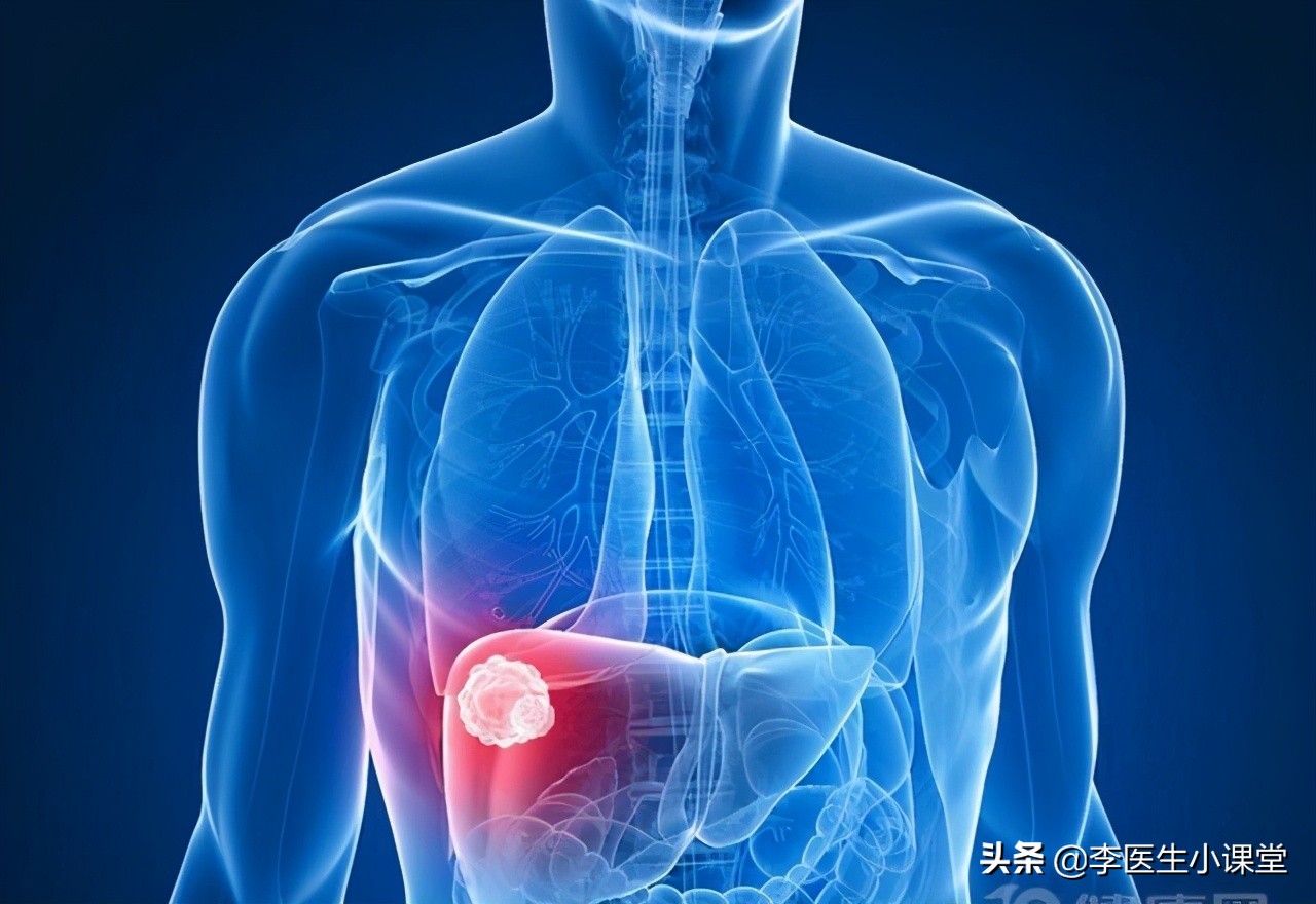 肝癌晚期真的是必死无疑吗,肝癌晚期为什么还可以活很久