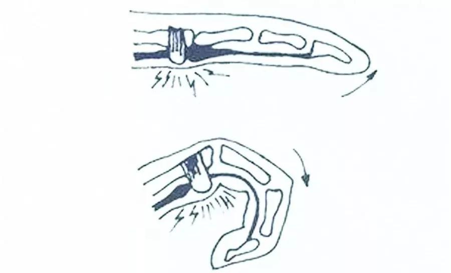 手指关节疼医生说没事是什么原因,有一个手指伸不开特别疼