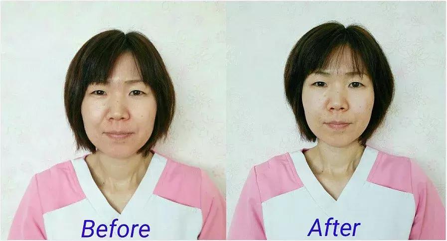 暧昧行为后遗症,爱美人士的危害