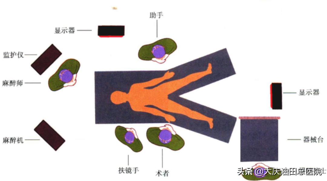 84岁老人直肠癌微创手术,直肠癌手术成功无转移