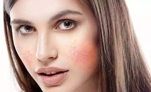 洗脸后皮肤干燥、起皮，不一定是洗面奶问题！可能是这些错误行为