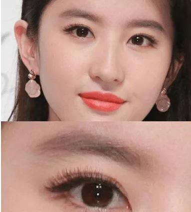 欧式双眼皮适用什么眼型,双眼皮平行型和欧式型有什么区别