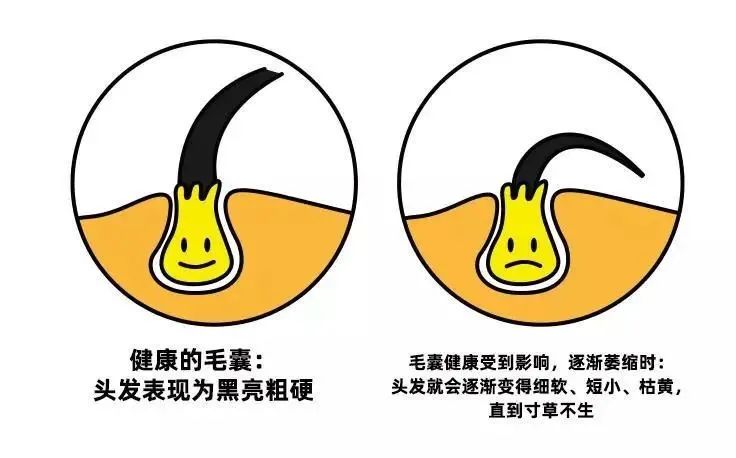 年轻人长了一根白头发能不能拔,年纪轻轻白头发越来越多怎么回事