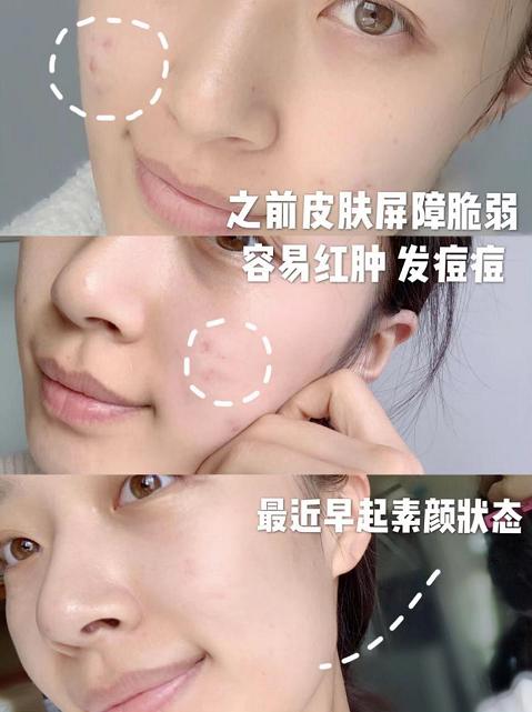 新西兰羊奶对比国内羊奶,为什么新西兰羊奶好